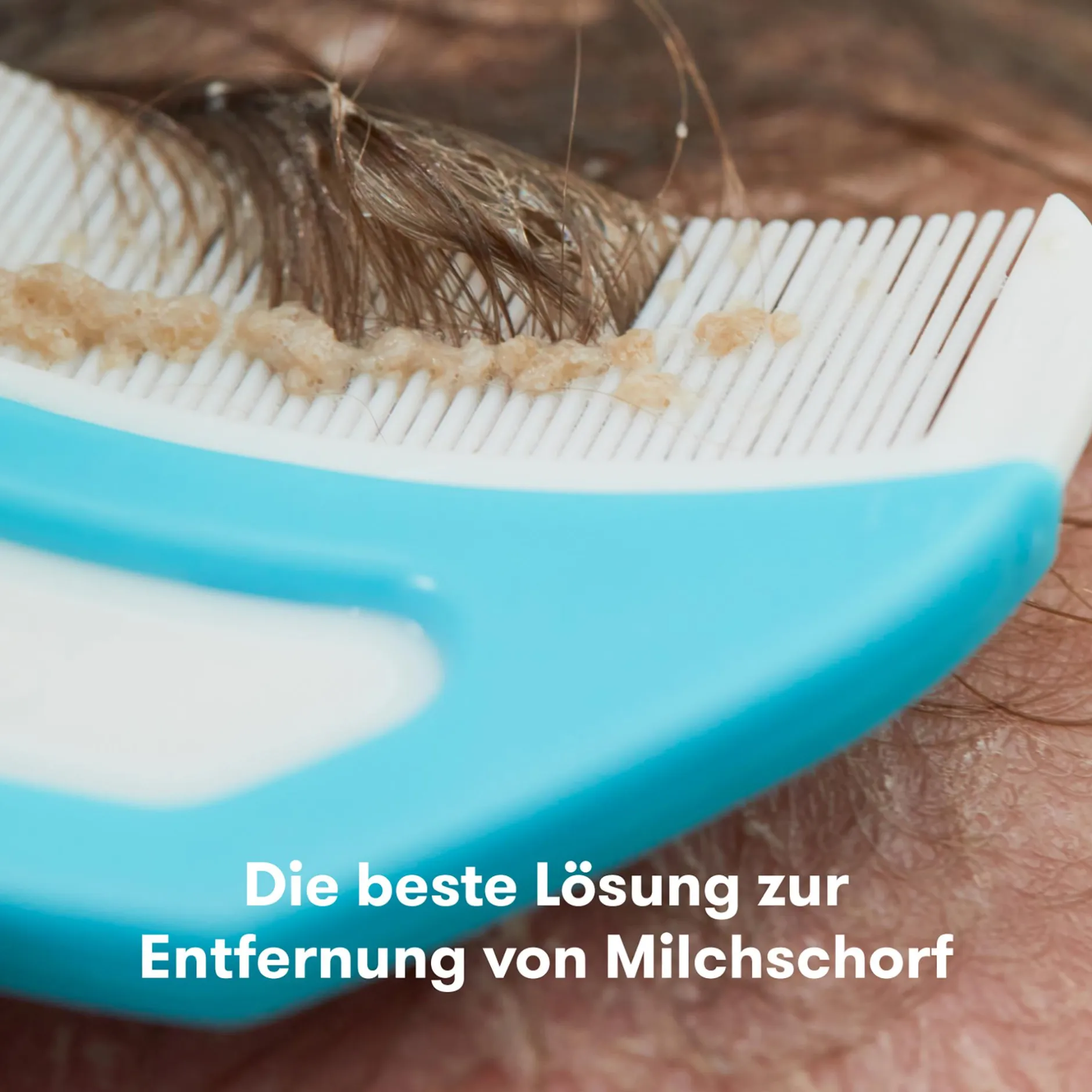 Frida baby Flake Fixer 3in1 Milchschorf-Set* Hausapotheke